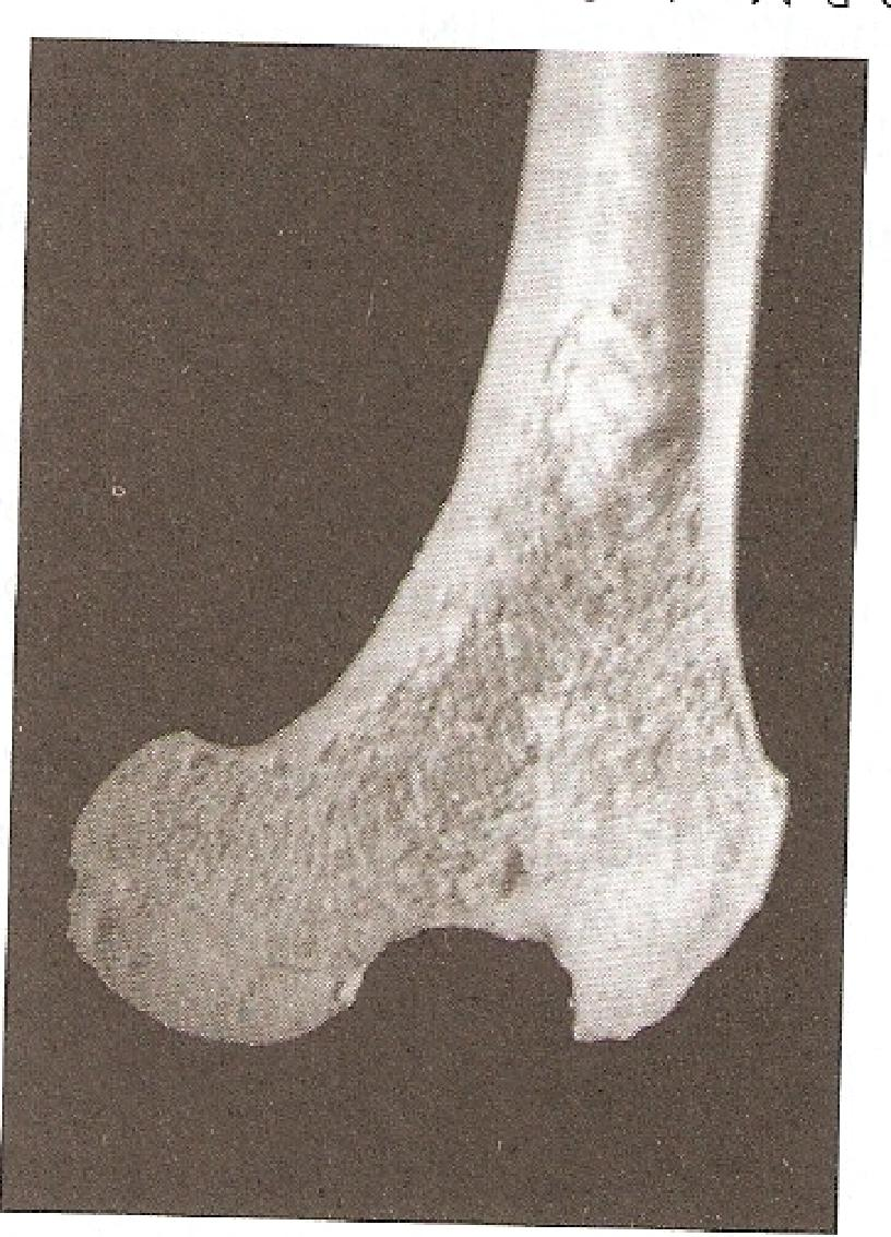 DEFINIÇÃO A maioria dos materiais sólidos que não são polímeros, metais ou derivados de plantas e animais são cerâmicas. (Richerson, 2000).