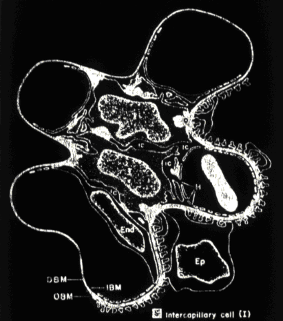 MECANISMO NÃO IMUNE DE LESÃO RENAL