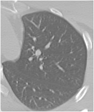 (a) (b) (a) Imagem de tomografia computadorizada de uma fatia de um pulmão com tons de cinza de 0 a