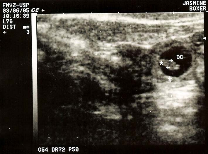 RESULTADOS 55 Figura 2 Imagem ultra-sonográfica de gestação no 24º dia, demonstrando a placenta (#) como uma formação hiperecóica contituindo a parede da vesícula embrionária e em seu