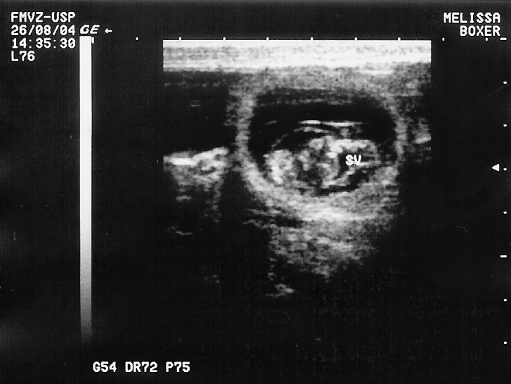 feto. As cabeças de setas sólidas indicam o CCR e a letra E refere-se ao estômago fetal representado por uma cavidade anaecóica.