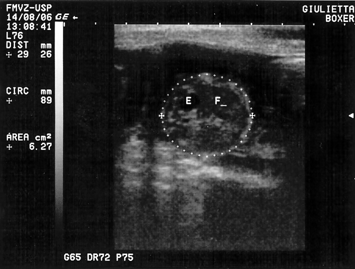 7 Imagem ultra-sonográfica de gestação no 46º dia, ilustrando o corpo fetal em secção