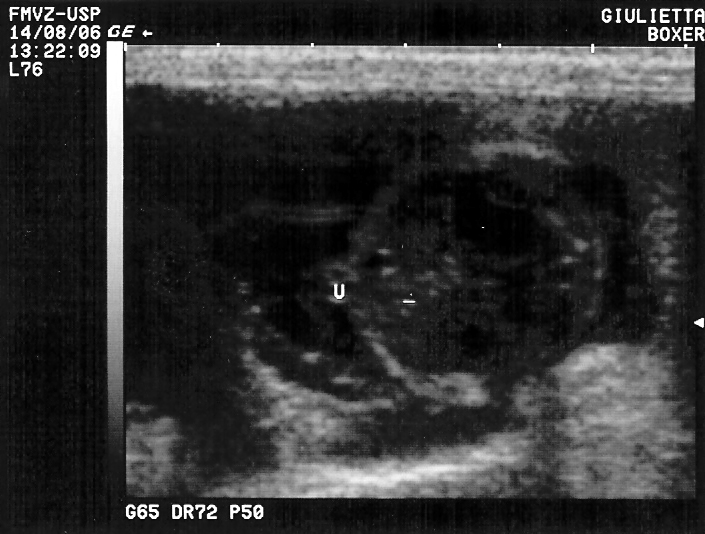 O estômago fetal está repleto e apontado pela letra E Figura 9 Imagem ultra-sonográfica de gestação no