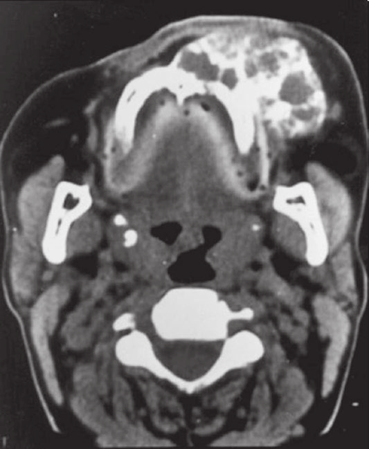 Imaginologia 25 a b Figura 1.17 Imagem de TC, janela para tecido mole: (A) corte axial; (B) corte coronal.