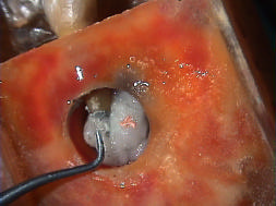 ápice dental voltado para cima (Fig. 4.6).