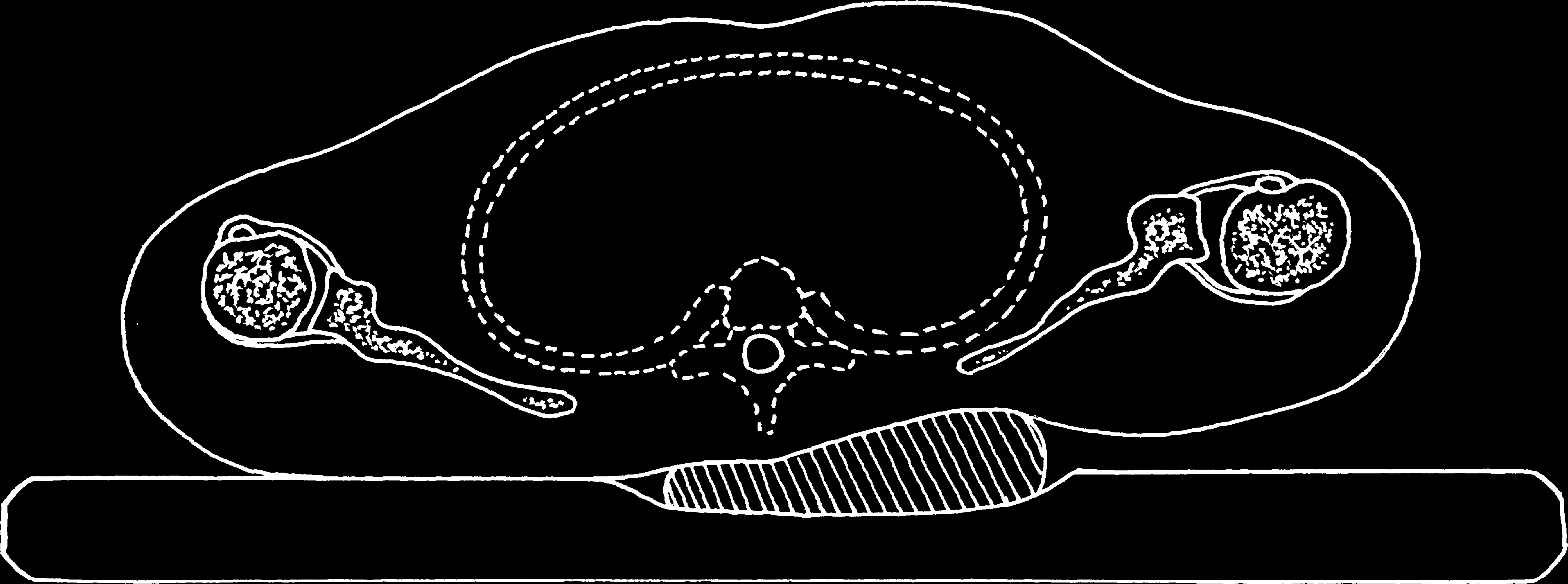 > Vias de acesso ao membro superior 1629 às cirurgias mais frequentes do membro superior.