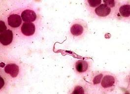 Trypanosoma cruzi