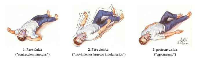 Referências http://www.healthcommunities.com/epilepsyseizures/symptoms.shtml http://www.ilae.org/ Associação brasileira de epilepsia http://www.