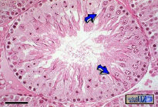 espermátides e espermatozóides) e células sustentaculares