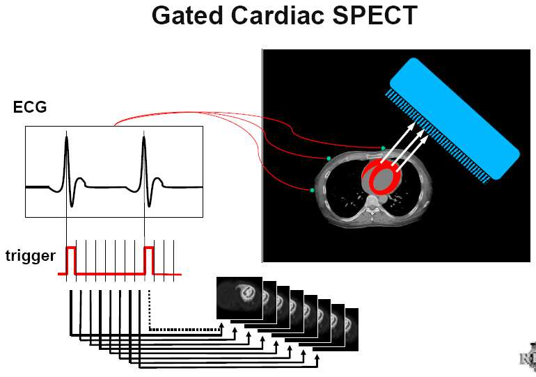 Frames sincronizados com o ritmo cardíaco durante um cíclo são adquiridas várias
