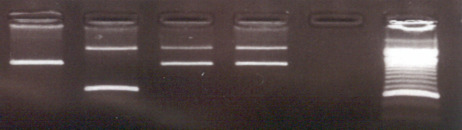 Sequenciação automática de fragmentos de DA obtidos por PCR (c.20a>t) p.