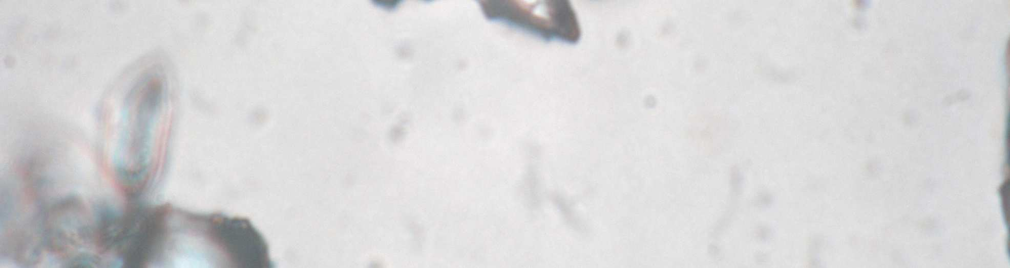 microscopia dos grânulos das