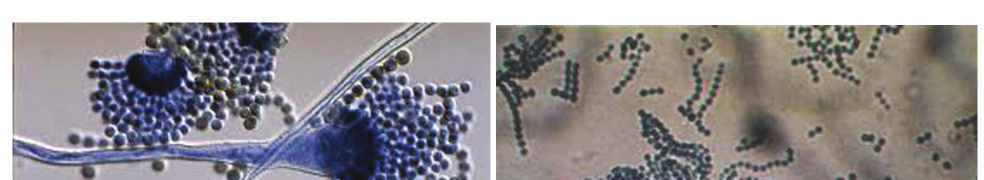 29 Figura 5 Imagens microscópicas dos fungos: (A) Aspergillus sp.; (B) Penicillium sp. Fonte: www.google.com.