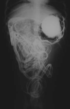 29 Figura 3 - Radiografias abdominais em projeção lateral direita (A) e ventrodorsal (B), após a administração do sulfato de bário (meio de