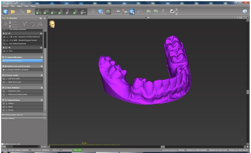 Fluxo de trabalho codiagnostix TM 2.