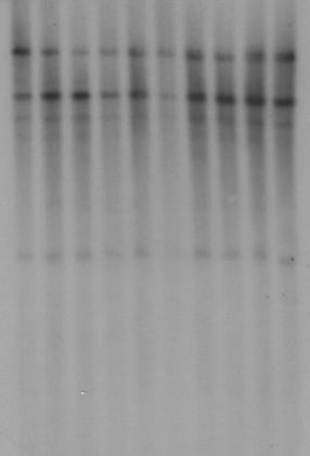 Glicerol MegaBACE / ABI377