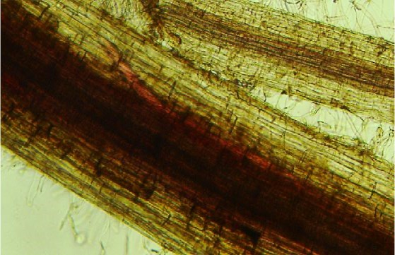 Penetração e Reprodução de Heterodera glycines, raça 3, em algumas espécies vegetais. Nematologia Brasileira, 24 (1): 27-32, 2000. Fenner LM.