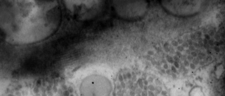 As setas indicam partículas baciliformes contidas em cisternas do retículo endoplasmático. A P. edulis sp.; B P. morifolia 4.