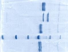 Yeast recombinant CS proteins of P. vivax Synthetic genes: codon optmized Cloning ppic9k Expression P. pastoris 116.0 66.2 45.0 35.0 25.