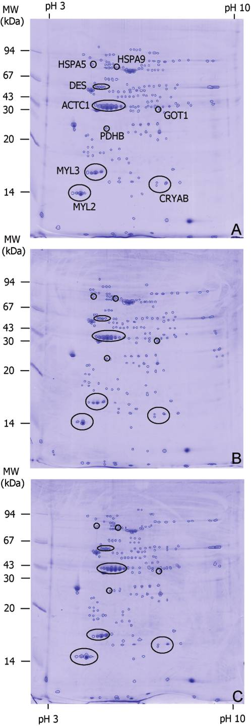 Figure 4. Two-dimensional electrophoresis gels of left ventricle homogenates obtained from uninfected animals (A), Trypanosoma cruzi infected animals without signs of acute-phase infection (B), and T.