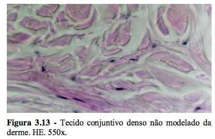 Tecido Denso Não Modelado Fibras colágenas dispostas pelos fibroblastos em diferentes direções, dando ao tecido resistência às trações