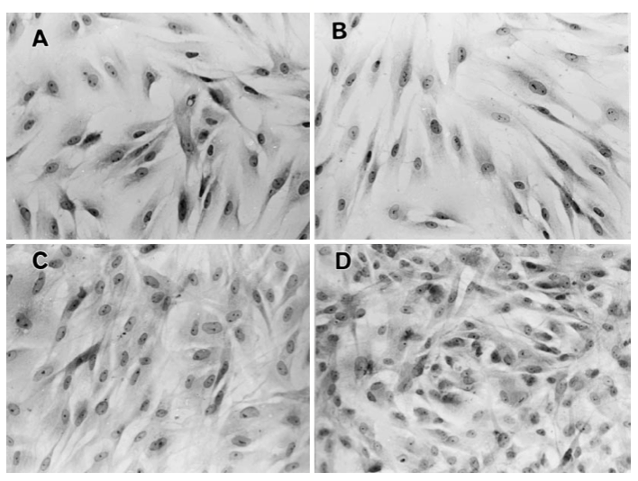 9 Fibroblastos