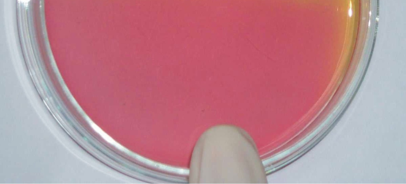 Enterobactérias, Staphylococcus sp.