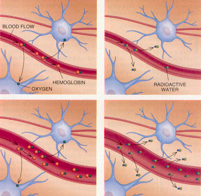 IMAGIOLOGIA CEREBRAL RM funcional PET E. repouso RMf quando os neurónios se tornam activos o seu fluxo sanguíneo aumenta.