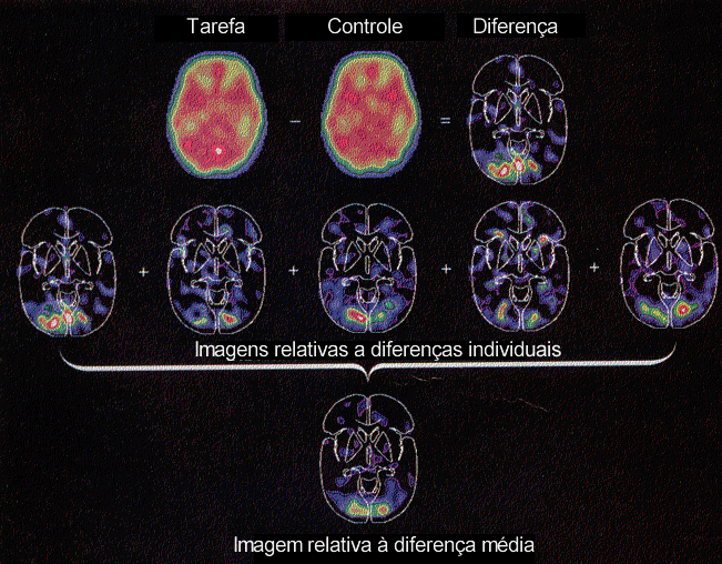 IMAGIOLOGIA CEREBRAL Subtracção de imagem e cálculo da média como base da