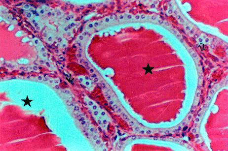 FIGURA 1: Glândula endócrina vesicular ou folicular, H&E Notar: folículos tireoidianos com colóide («) e células parafoliculares (ð) e tecido conjuntivo interfolicular (è). Fonte: acd.ufrj.