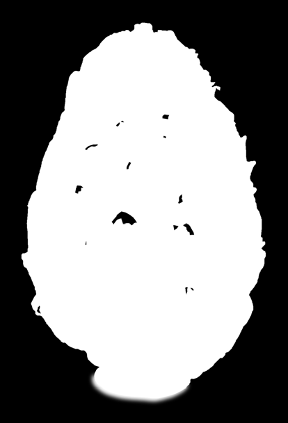 Faça uma moldura na borda do acetato e molde mini rosetas para formar um desenho e rendar o seu ovo, limpando o