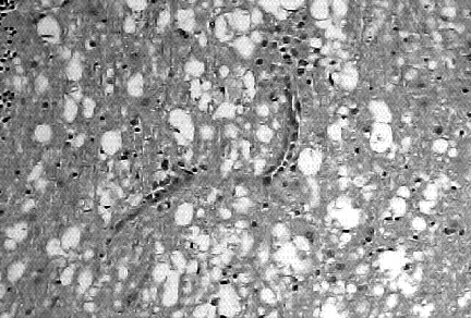 grandes manguitos perivasculares formados por quatro a cinco camadas de células mononucleares, astrogliose e astrocitose (1) Animais jovens: idade inferior a seis meses.
