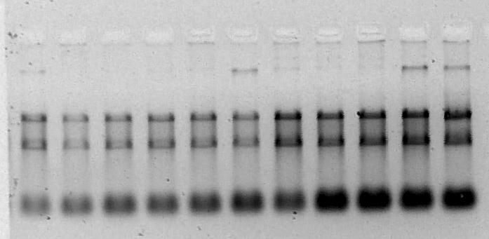 58 Ao final do processo, a concentração do RNA total recuperado foi mensurada por espectofotometria (Biophotometer; marca Eppendorf).