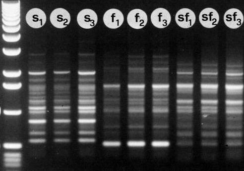 Reação de PCR Componentes para a reação:
