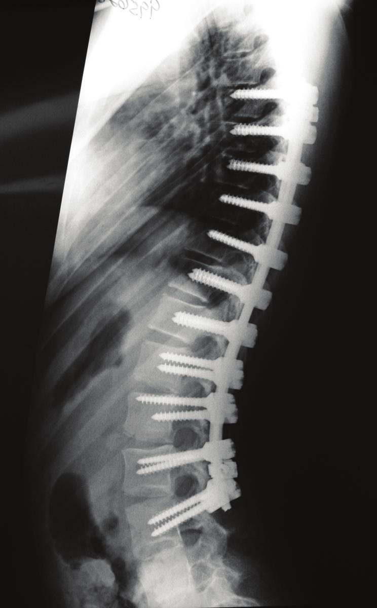 paciente Data da cirurgia: 3 de julho de 2007 Internação: De 3 a 7 de julho de 2007 19/07/2007 Remoção das suturas, paciente