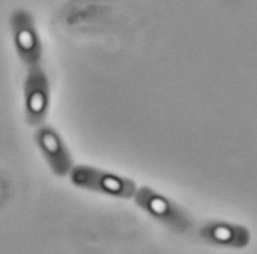 Figura 3 - Imagens de isolados de Bacillus thuringiensis obtidas em microscoscópio de contraste de fase E- Esporo, C- Cristal. REFERÊNCIAS ALBEROLA, T., S. APTOSOGLOU, M. ARSENAKIS, Y. BEL, G.