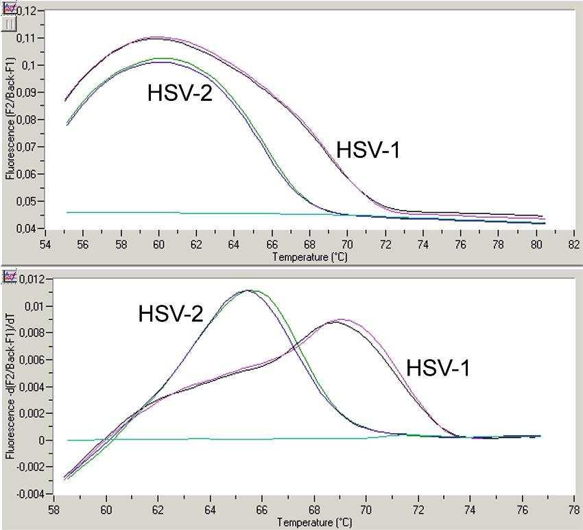 Fig. 12: Diferença entre HSV-1 e HSV-2 no canal de fluorescência