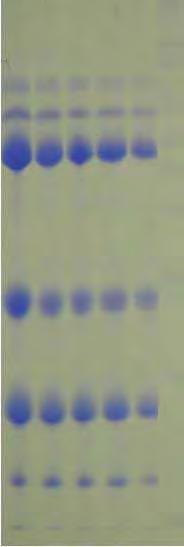 54 APÊNDICE A 1 2 10% 20% 30% P Transferrina Albumina sérica Imunoglobulina G de cadeia pesada Imunoglobulina G de cadeia leve β-lactoglobulina α-lactoalbumina Figura 1A.