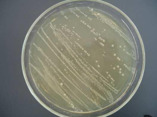 FIGURA 01- Cepa gram positiva, isolada de cloaca de avestruz