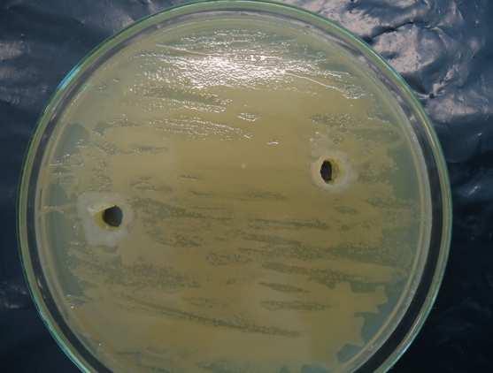 Na avaliação da atividade antimicrobiana, a cepa 18 apresentou halo de crescimento (0,2cm) inibindo o Staphylococcus aureus (fig. 04). Quanto aos outros patôgenos analisados, não houve inibição (fig.