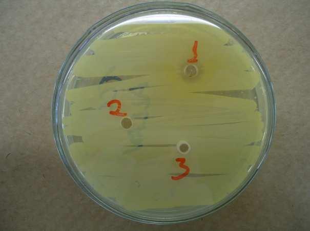 TABELA 1 - CARACTERÍSTICAS DAS CEPAS GRAM POSITIVO ISOLADAS DA CLOACA DE A AVESTRUZ (Struthio camelus) SELECIONADAS n de identificação da cepa isolada Morfologia ph do caldo MRS após 24 horas de