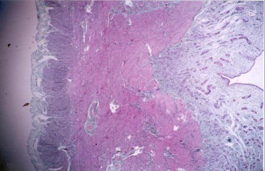 45 P M E LE CI Figura 1: Fotomicrografia das três camadas do útero: endométrio (E),