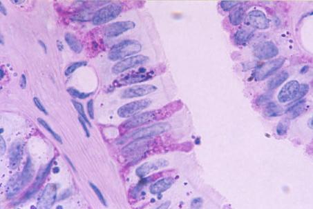 CS CC CB Figura 17: Fotomicrografia do epitélio de revestimento da tuba uterina, na