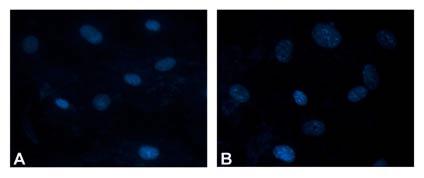 GINANI et al. Figura 2 - Fotomicrografia das células do Grupo I (A) e Grupo II (B), após 72 horas de cultivo celular.