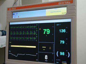 22 Figura 3: Registro da pressão arterial. Monitor DIXTAL 2023. Fonte: O autor (2013). 3.2.7 Modulação autonômica cardíaca A avaliação da modulação autonômica cardíaca, durante o repouso e o exercício físico, foi realizada pelo método indireto da VFC (STEIN et al.