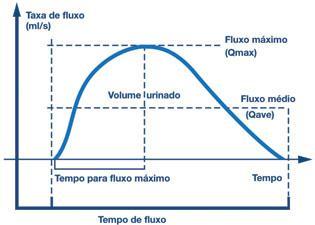 UROFLUXOMETRIA Volume urinado em ml/seg Deve ser