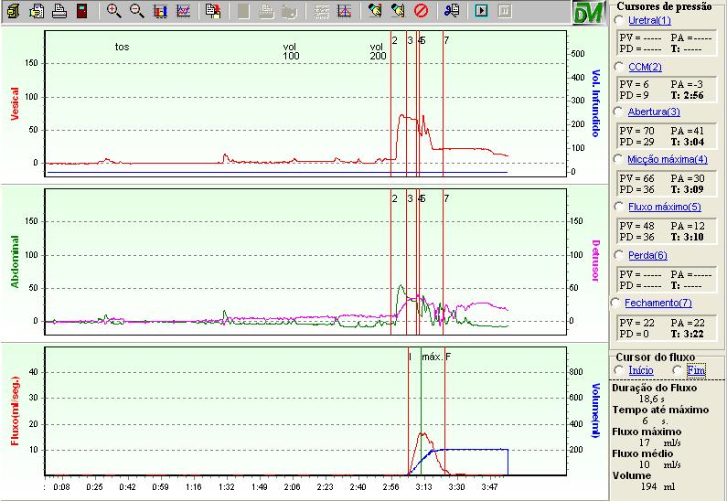 CISTOMETRIA FASE DE