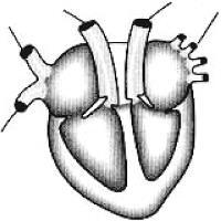 03. (Usf 2016) Segundo a Organização Mundial da Saúde (OMS), as doenças cardiovasculares são as principais causas mundiais de morte.