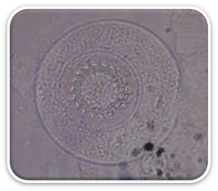 17 Doenças Parasitárias e Manejo Profilático de Tambaquis Protozoários Descrição geral Em tambaquis foram encontradas três espécies de parasitos protozoários, a Trichodina sp.