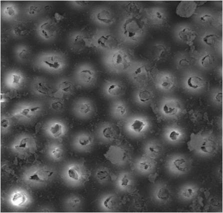52 Figura 18 - Fotomicrografia obtida do terço apical após instrumentação rotatória Biorace e irrigação com hipoclorito de sódio 5,25% (G1.